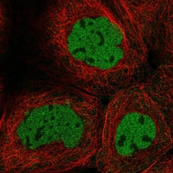 Caspase-2 Antibody, Novus Biologicals 0.1mL; Unlabeled:Antibodies, Polyclonal